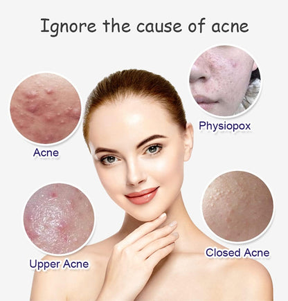 Aichun Beauty Anti-Acne Whitening Facial Serum – 30ml - Product Image 2