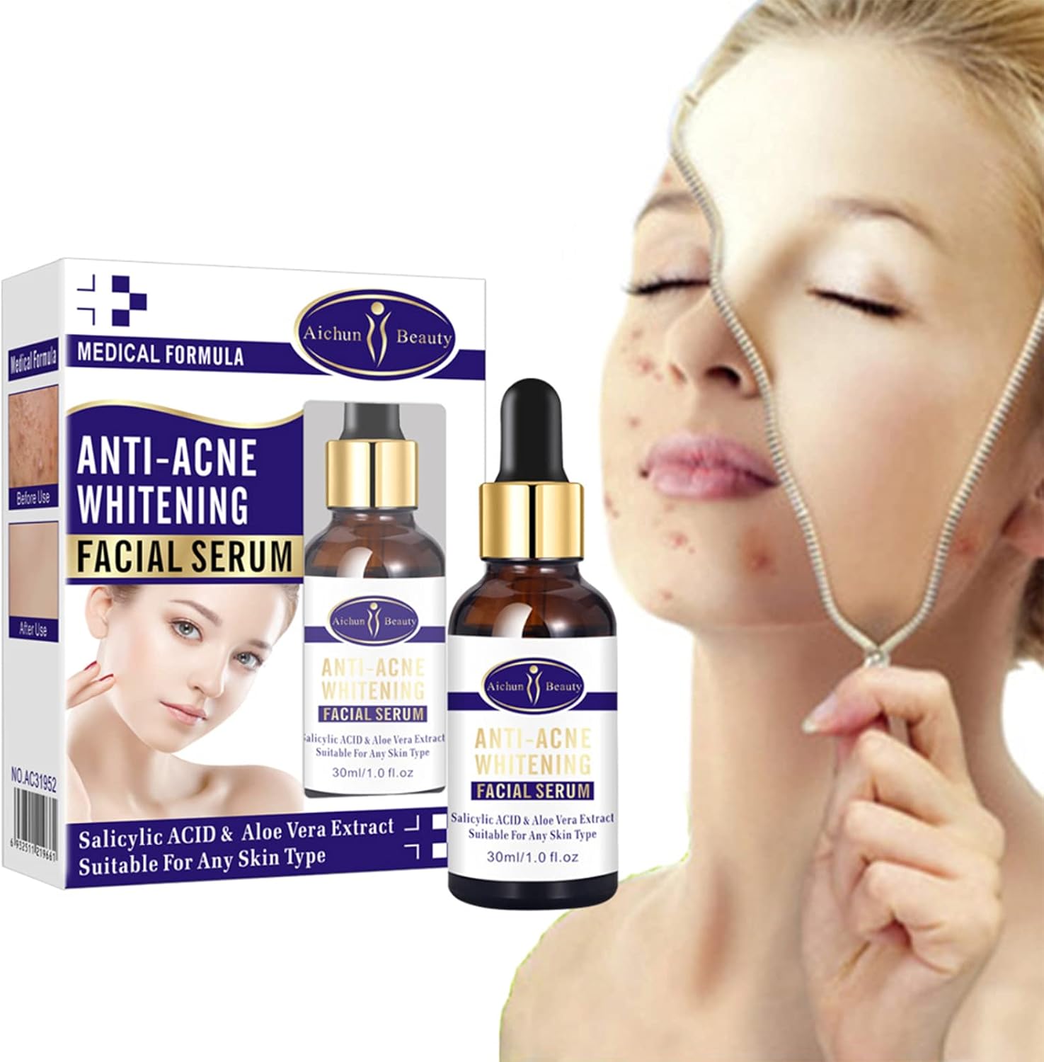 Aichun Beauty Anti-Acne Whitening Facial Serum – 30ml - Product Image 5